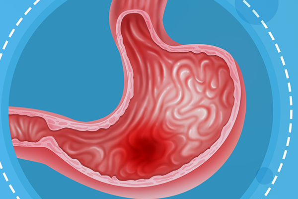 大蒜抗癌是真的吗 大蒜为什么可以抗癌